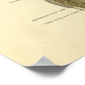 Schultergelenk Anatomie Druck Poster (Ecke)