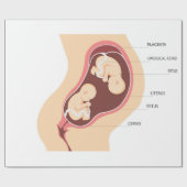 Schwangere Geschenkpapier (Flach)