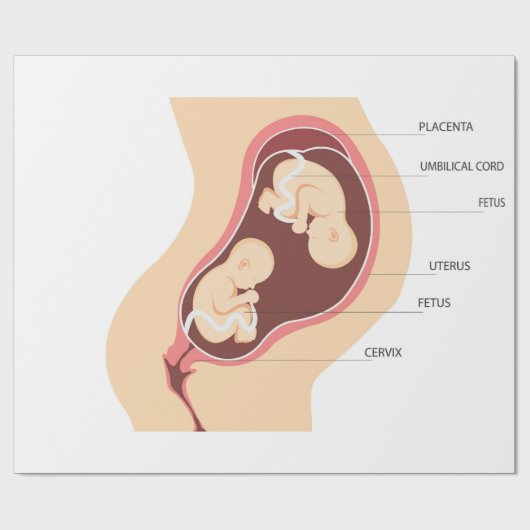 Schwangere Geschenkpapier (Flach)
