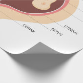 Schwangere Geschenkpapier (Ecke)