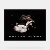 Schwangerschaft Ankündigung Baby Dusche Sonogramm Acrylschild (Vorderseite)