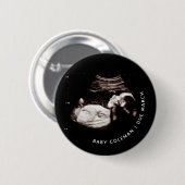 Schwangerschaft Ankündigung Baby Sonogram Foto Button (Vorne & Hinten)