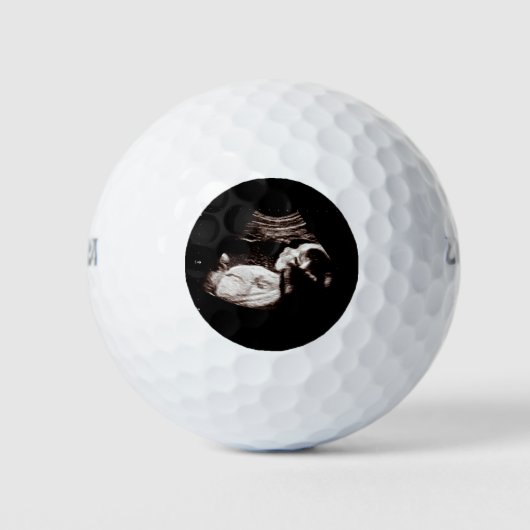 Schwangerschaft Baby Sonogram Ultraschall Foto Män Golfball (Vorderseite)