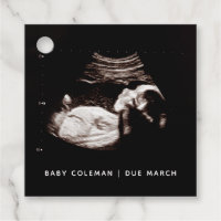 Schwangerschaft Baby Sonogram Ultraschallgerät Fot