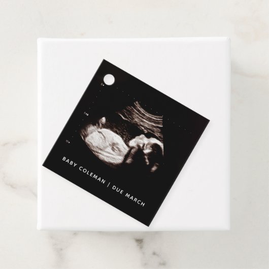 Schwangerschaft Baby Sonogram Ultraschallgerät Fot Geschenkanhänger (Beispiel)