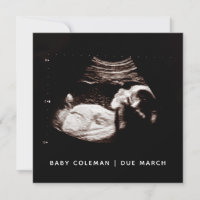 Schwangerschaft Baby Sonogramm Ultraschallfotokart