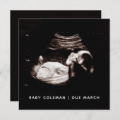 Schwangerschaft Baby Sonogramm Ultraschallfotokart (Vorne/Hinten)