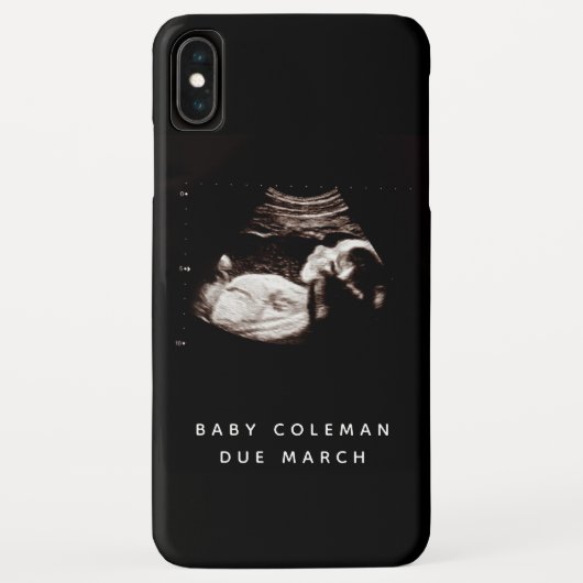 Schwangerschaft Baby Sonogramm Ultrasound Foto Case-Mate iPhone Hülle (Rückseite)