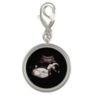 Schwangerschaft Baby Sonogramm Ultrasound Foto Sch Charm