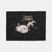 Schwangerschaft Keepake Baby Ultrasound Sonogramm  Fleecedecke (Vorderseite (Horizontal))