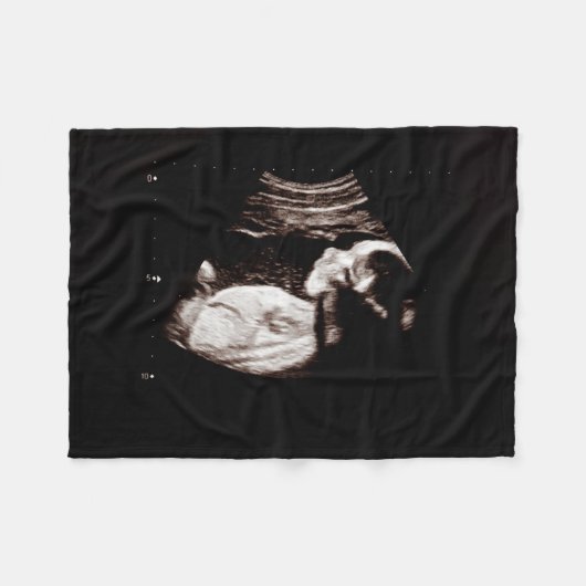 Schwangerschaft Keepake Baby Ultrasound Sonogramm Fleecedecke (Vorderseite (Horizontal))