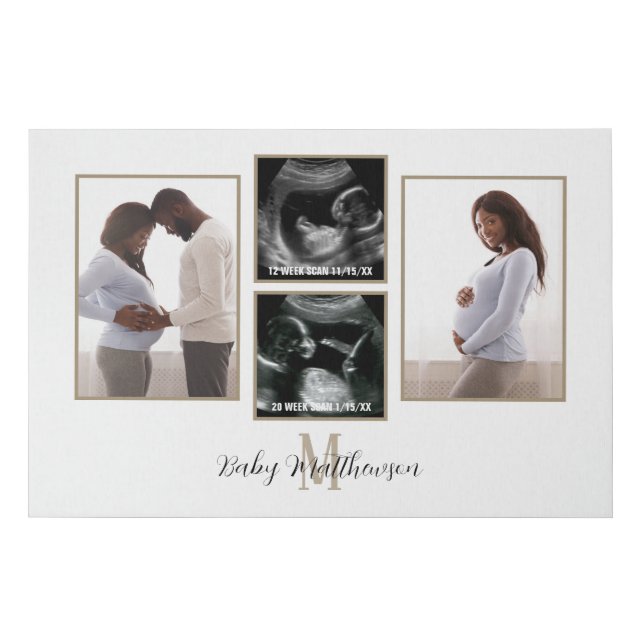 Schwangerschaft Kollage 4 Fotos Monogramm Künstlicher Leinwanddruck (Vorderseite)