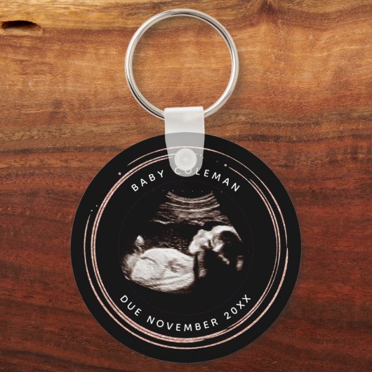 Schwangerschaft Pink Glitzer Sonogramm Ultraschall Schlüsselanhänger (Vorderseite)