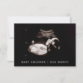 Schwangerschaft Reveal Baby Ultrasound Sonogramm F Mitteilungskarte (Vorderseite)