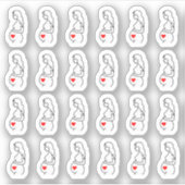 Schwangerschaft Ultrasound Baby Checkup Tracker Pl Aufkleber (Vorderseite)