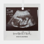 Schwangerschaft Ultrasound Foto Erster Weihnachtsf Ornament Aus Glas (Rückseite)