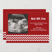 Schwangerschaft Weihnachtskarten Ultrasound Ankünd Feiertagskarte (Vorne/Hinten)