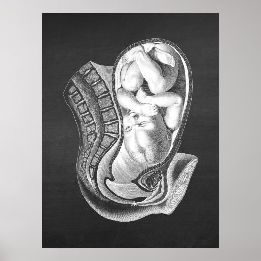 Schwangerschaft Womb Anatomie Obstetrische Dekorat Poster (Vorne)