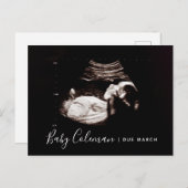 Schwangerschaftsankündigung Sonogramm erwartet Pos Ankündigungspostkarte (Vorne/Hinten)