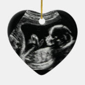 Schwangerschaftsankündigung Ultra Sound Weihnachte Keramik Ornament (Hinten)