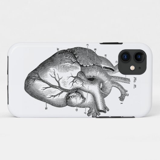 Schwarzes anatomisches Herz Case-Mate iPhone Hülle (Rückseite (Horizontal))