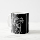 Schwarzes anatomisches Herz Kaffeetasse (Vorderseite Links)