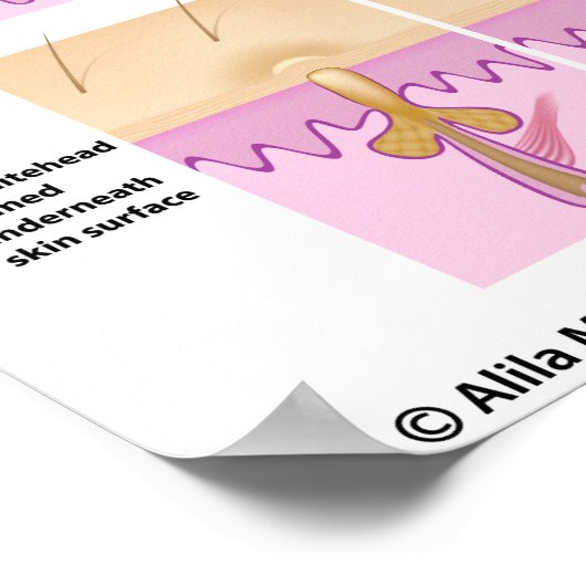 Schwarzkopfplakat Poster (Ecke)