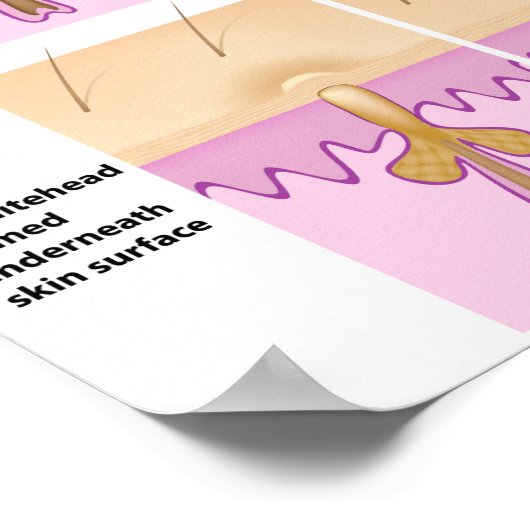 Schwarzkopfplakat Poster (Ecke)