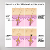 Schwarzkopfplakat Poster (Vorne)