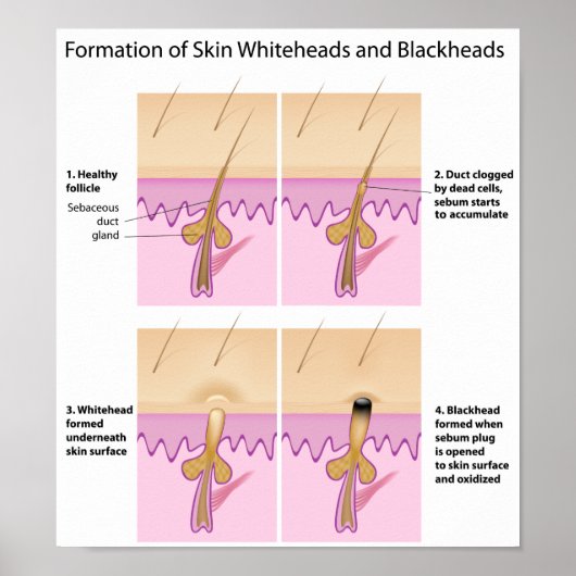 Schwarzkopfplakat Poster (Vorne)