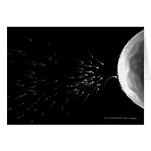 Schwarzweiss-Illustration der Düngung