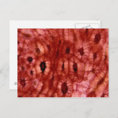 Sclerenchyma Zellen aus der Kirschgrube Postkarte (Vorne/Hinten)