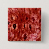 Sclerenchyma Zellen von einer Kirschgrube Button (Vorderseite)