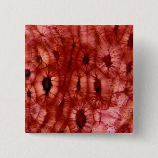 Sclerenchyma Zellen von einer Kirschgrube Button (Vorderseite)