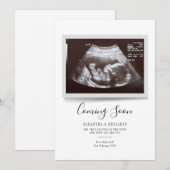 Script Sonogram Kommt bald Schwangerschaftsankündi (Vorne/Hinten)