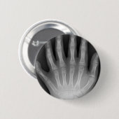 Sechs fingrige Hand, medizinische Rarität, Button (Vorne & Hinten)