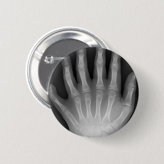 Sechs fingrige Hand, medizinische Rarität, Button (Vorne & Hinten)