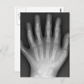 Sechs fingrige Hand, medizinische Rarität, Postkarte (Vorne/Hinten)