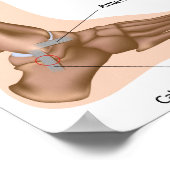 Seitliche Knöchelbesprühte Poster (Ecke)
