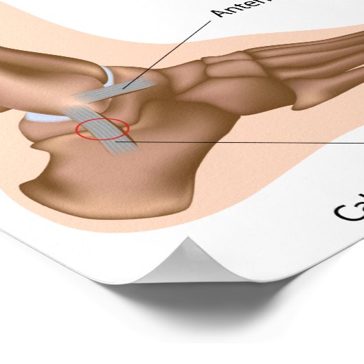 Seitliche Knöchelbesprühte Poster (Ecke)