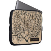 Sepia Black Vintag Neuron Zeichnend Neurologie Nam Laptopschutzhülle (Vorne Rechts)