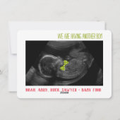 Sexuelle Aufdeckung des Kindertages Ultraschallkar Feiertagskarte (Rückseite)