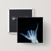 Shaka Sign X-Ray (Hang Loose) Button (Vorne & Hinten)