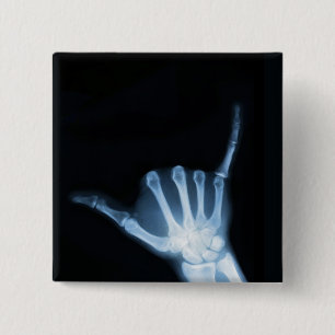 Shaka Sign X-Ray (Hang Loose) Button