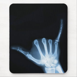 Shaka Sign X-Ray (Hang Loose) Mousepad