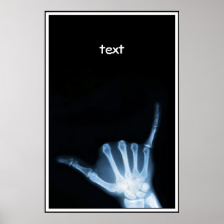 Shaka Sign X-Ray (Hang Loose) Poster