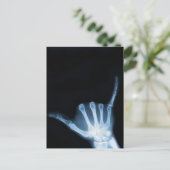 Shaka Sign X-Ray (Hang Loose) Postkarte (Stehend Vorderseite)