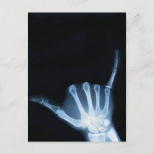 Shaka Sign X-Ray (Hang Loose) Postkarte
