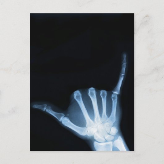 Shaka Sign X-Ray (Hang Loose) Postkarte (Vorderseite)