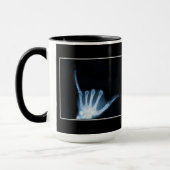 Shaka Sign X-Ray (Hang Loose) Tasse (Links)